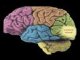 20080305105415-cerebro.jpg