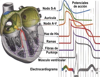 20090319150202-electrocardiograma.jpg